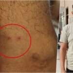 Vikas Dwivedi was bitten by a snake for the 8th time amidst the crowd, he got death threat in his dr...