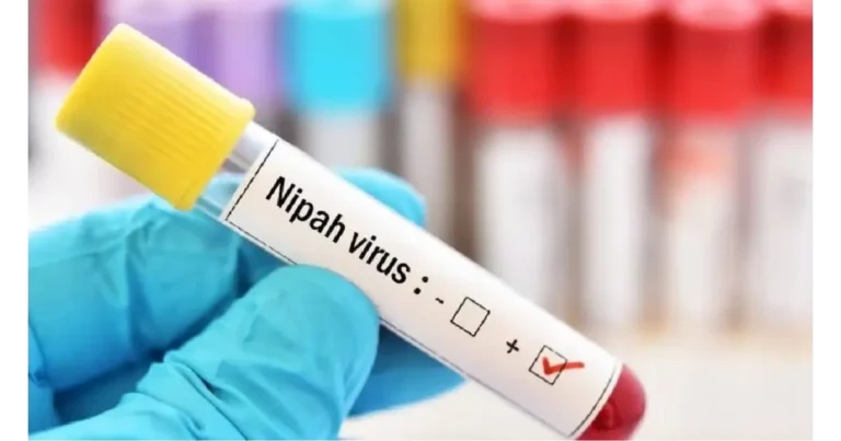 Nipah Virus