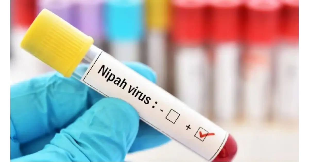 Nipah Virus